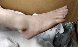 阿加鲁170 佳桃 开箱速拍